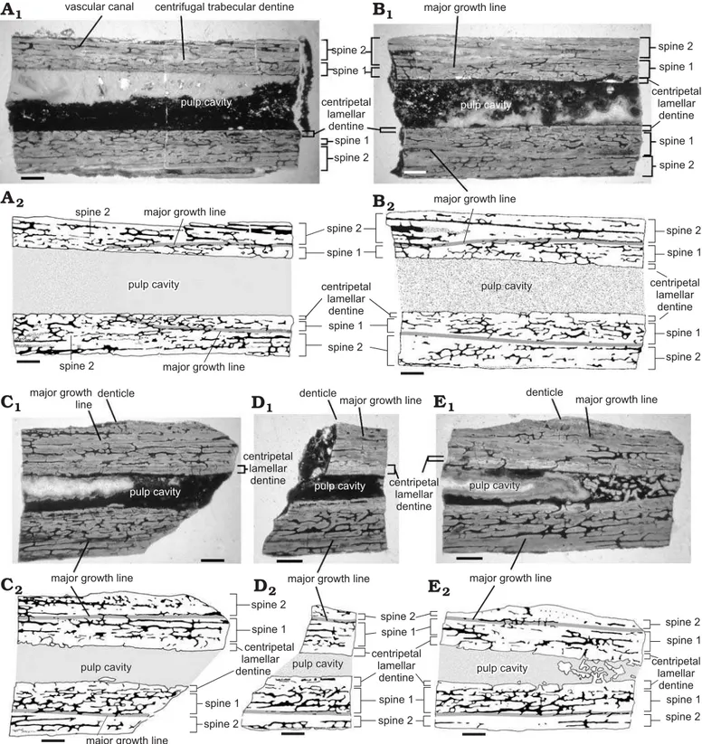 Fig. 4. Serial longitudinal sections of dorsal spine of Orthacanthus platypternus (Cope, 1884), Lower Permian, Craddock Bone Bed, Texas, USA; speci- speci-men HMNS-T2, where A represents the most proximal section and E is the most distal