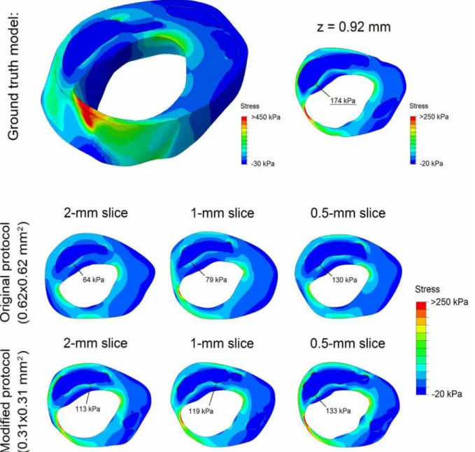 Fig 6. Stress distribution in an example 3D ground truth model (top row) and the stress distributions in its 6 2D MRI segmentation models (middle and bottom rows)