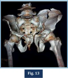 Fig. 14  Fig. 15 