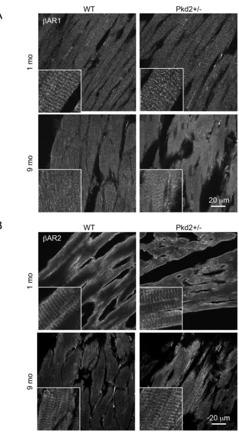 Fig 6. β-Adrenergic receptor expression is altered in 9 mo Pkd2+/- mice. (A) Staining intensity for βAR-1 was similar in 1 and 9 mo WT and Pkd2+/- mice