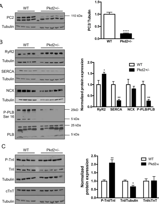 Fig 1. Expression of calcium handling and contractile proteins in 9 mo WT and Pkd2+/- mice