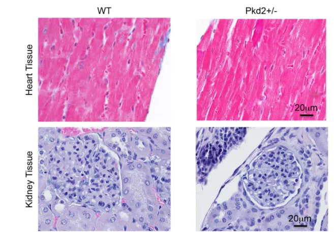 Fig 3. No gross cardiac or renal abnormalities in WT and Pkd2+/- mice. (A) Left ventricles from 9 mo WT (left) and Pkd2+/- (right) mice show similar Masson ’ s Trichrome staining patterns with no signs of fibrosis