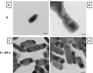 Figure 6. Immunogold electron microscopy and SEM analysis. Biofilm samples of strain x3339 flhCD containing either R995 + SPI-1 (Panels A and D) or R995 + SPI-1 SipA-FLAG (Panels B, C, and E) were processed for immunogold electron microscopy as described i