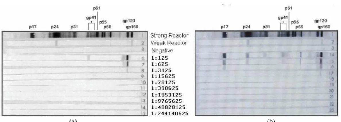 Fig. 5:  Representative  samples  of  Western  blot  HIV-1  positive  patients’  results  in  serially  diluted  samples  (five- (five-fold)
