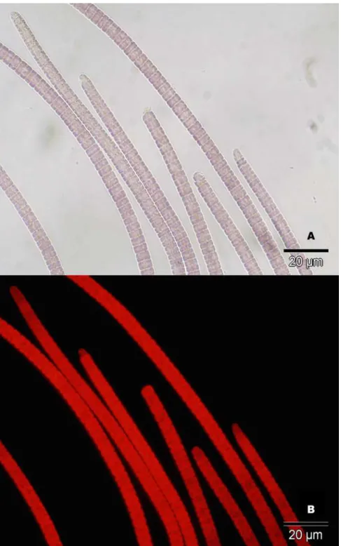 Fig 3. Microscopy images of cyanobacteria isolated from disease lesions. A) Cyanobacteria under light microscope