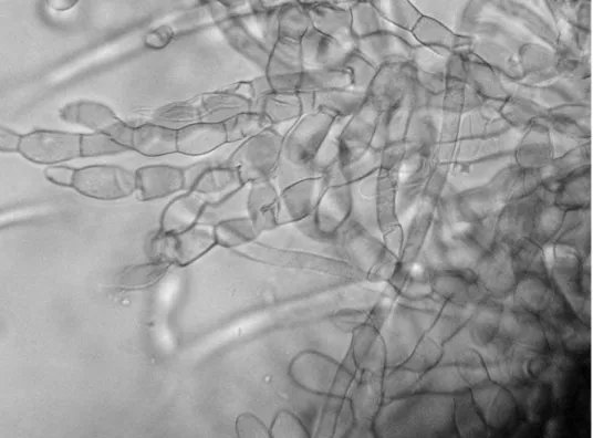 Figure 4. Multinucleate Rhizoctonia sp.: Moniliformous cells, detail