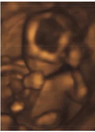 Figure 2. Ultrasound image of a fetus sucking the right thumb. Image credit: jenny cu (http://commons.wikimedia.org/wiki/File:Sucking_his_thumb_and_waving.jpg).