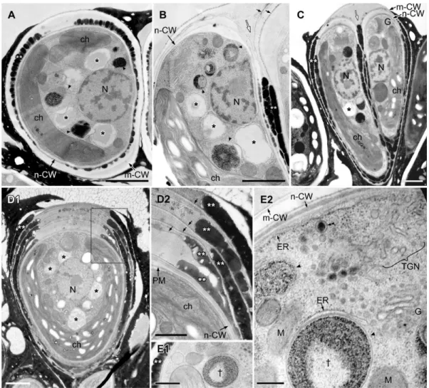 Figure 6. EM analysis of lipid bodies in a pair of daughter cells accumulating oil droplets