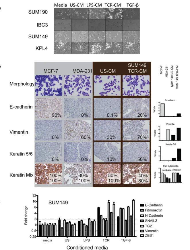 Fig 2. Conditioned media from activated healthy donor PBMC induces EMT in IBC. (a) Morphological changes visualized by bright field in IBC cell lines consistent with stress and EMT were observed following 48-hour incubation with CM