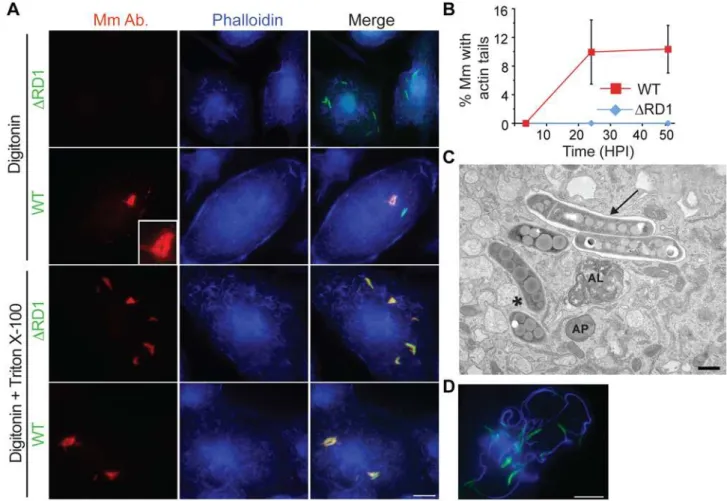 Figure 1. Mm escapes from phagosome by 3.5 HPI. (A) 3.5 HPI with DRD1 (1st and 3rd rows) or WT (2 nd and 4 th rows) Mm expressing GFP, macrophages were permeabilized with digitonin alone (top two rows) or digitonin followed by TX-100 (3 rd and 4 th row) as