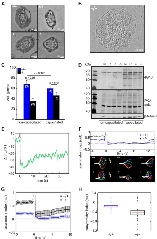 Figure 6. CRIS controls the development of flagellar bending. (A) Electron micrograph (cross section) of the midpiece (left) and principal piece (right) of the sperm flagellum from wild-type (+/+, top) and Cris-deficient (2/2, bottom) mice