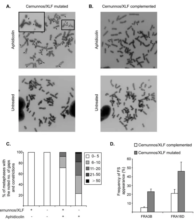 Figure 5. Cernunnos/XLF mutation leads to increased common fragile site instability. A