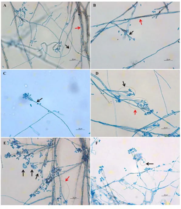 Figure 4 Microscopic morphology of D. eschscholtzii isolates. (A) Thin-walled and hyaline septate hy- hy-phae (black arrow), thick-walled and melanized septate hyhy-phae (red arrow)