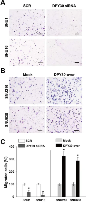 Fig 5. DPY30 regulated the invasion of gastric cancer cells. (A-B) A Matrigel invasion assay was used to measure gastric cancer cell invasion