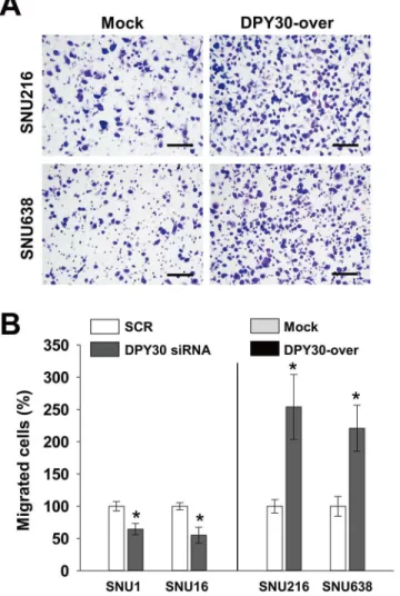 Fig 4. DPY30 regulated the migration of gastric cancer cells. (A) A Boyden chamber assay was used to measure the migration of gastric cancer cells