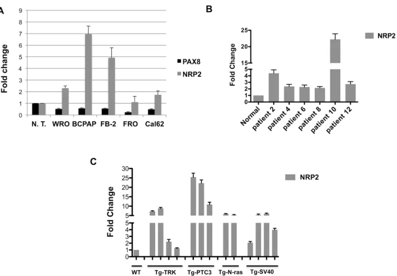 Fig 2. NRP2 expression in experimental models of thyroid carcinogenesis. (A) NRP2 and PAX8 expression was measured by qRT- PCR in five human thyroid cancer cell lines: WRO from follicular thyroid cancer, FB-2 and BCPAP from papillary thyroid carcinoma, Cal