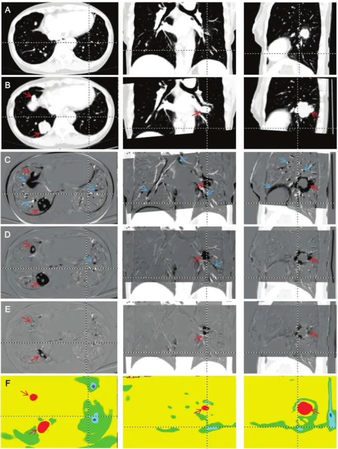 Figure 2. Comparison of three registration results. A: The original first time point image