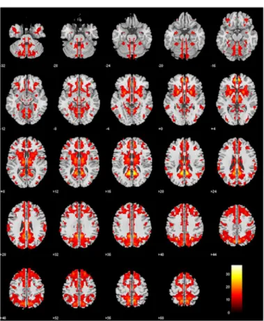 Fig 1. Normative VMHC map of the CN group (one-sample t-test, family-wise error corrected, p < 0.001, extent threshold = 10).