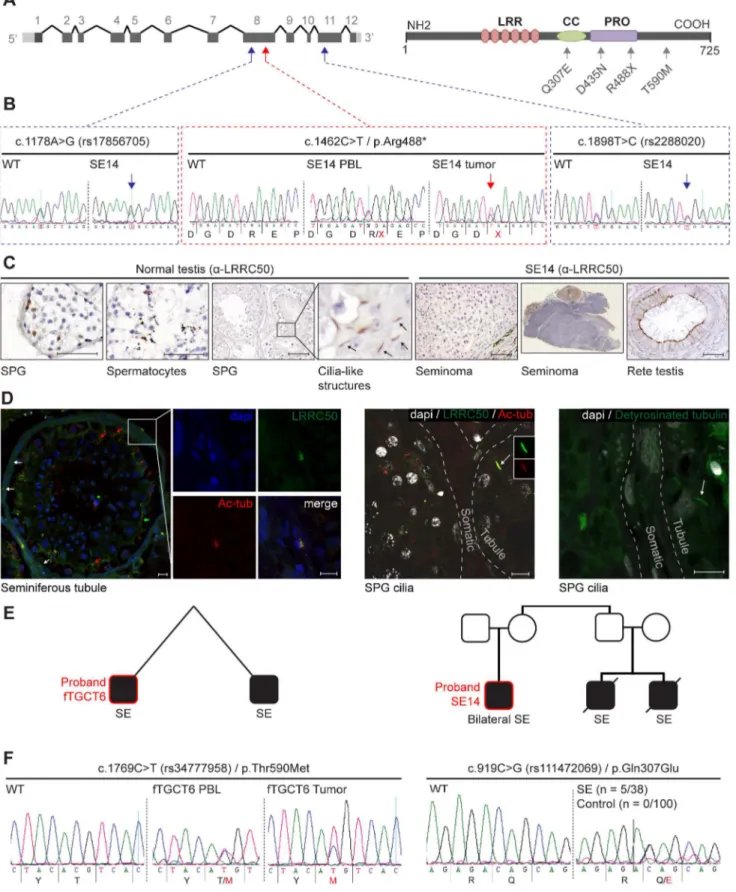 Figure 3. Genetic analysis of LRRC50 in human seminoma samples. (A) LRRC50 spans 12 exons on chromosomal arm band 16q24.1