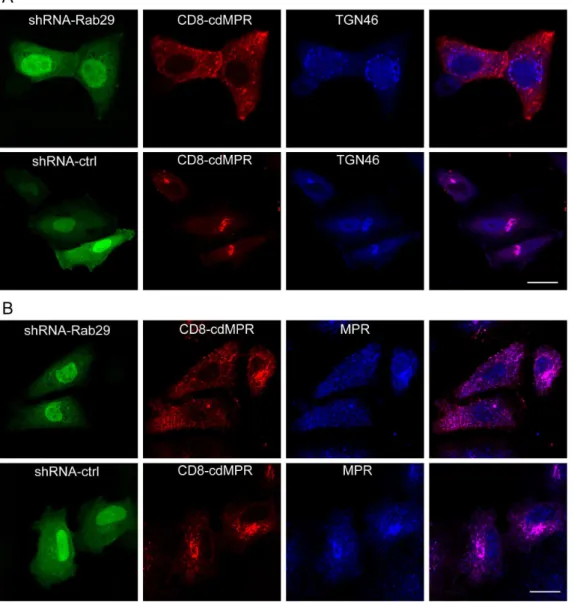 Figure 6. Rab29 regulates the retrograde trafficking of M6PR. A,B. HeLa cells were co-transfected CD8-cdM6PR or CD8-ciM6PR with myc- myc-Rab29WT, Rab29T21N or vector, respectively, then incubated with CD8 antibody and processed for the internalization and 