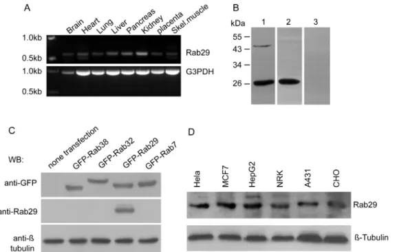 Figure 1. Examination of the expression of Rab29 and characterization of Rab29 antibody