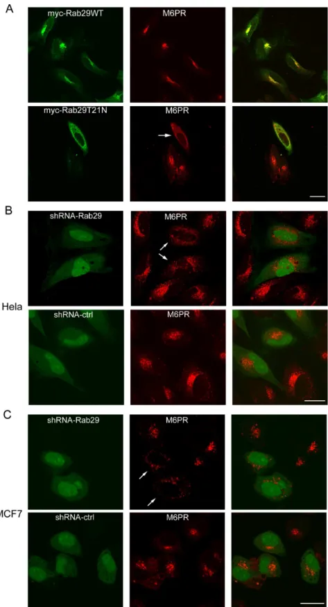 Figure 5. Rab29 regultes the distribution of M6PR. A. Hela cells transfected with myc-Rab29WT or myc-Rab29T21N were processed for immuno-staining with myc tag antibody and antibody against M6PR(300 Ka)