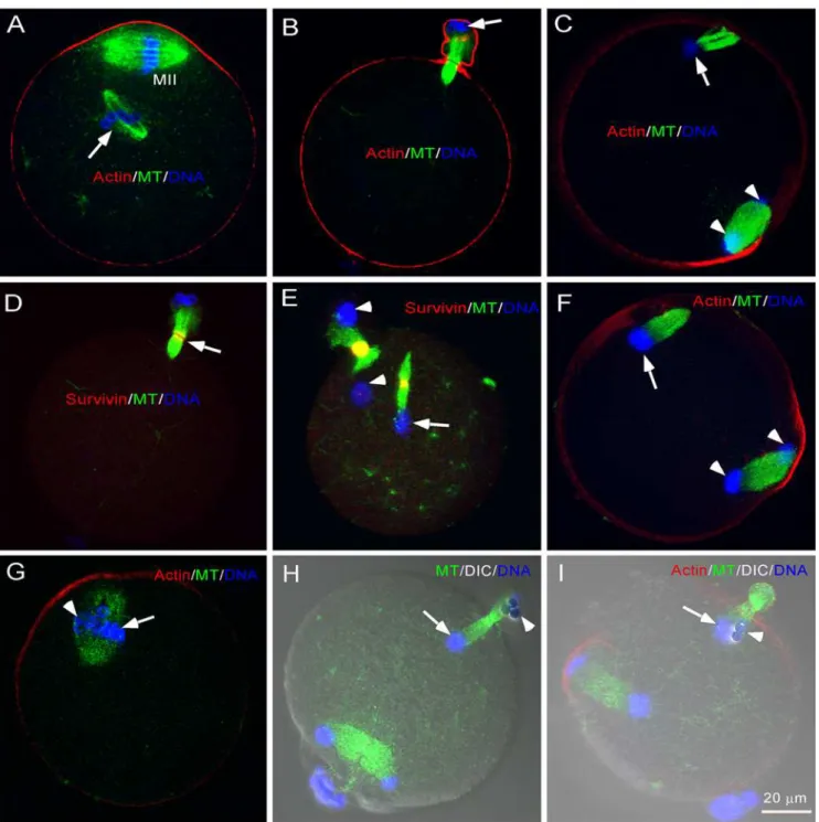Figure 1. Behavior of DNA beads and sperm chromatin in their assembled K-fiber-less spindles during anaphase of meiosis II