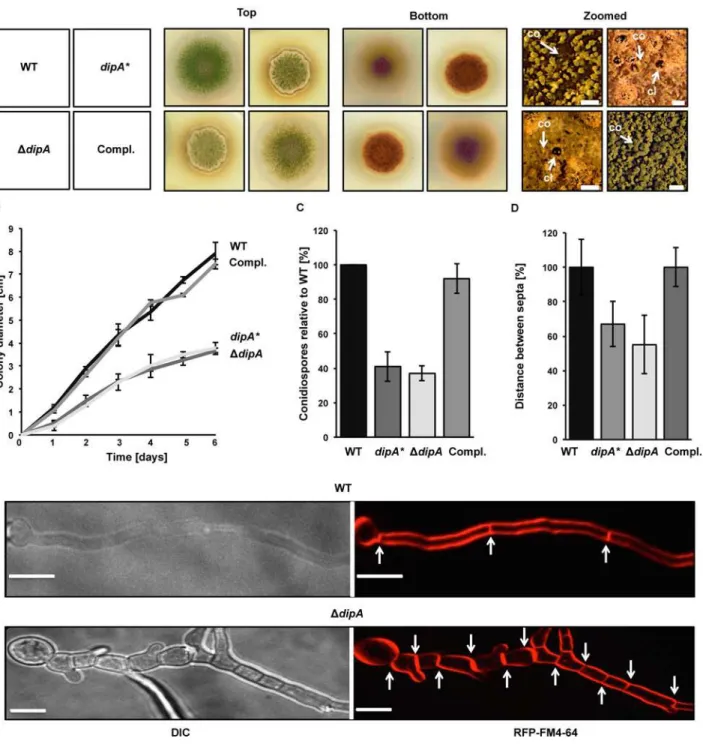 Fig 6. Phenotypical characterization of mutant strains lacking functional DipA. (A) Top and bottom view of point-inoculated wild type (WT), dipA * (codon exchange of catalytic core), dipA deletion (ΔdipA) and complementation (Compl.) strains incubated for 