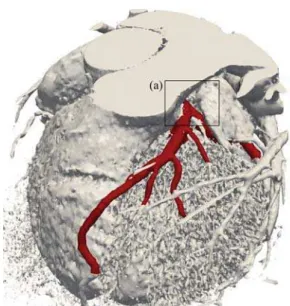 Fig. 2 – Volumetric model obtained from the original mul- mul-tislice computed tomography (MSCT) data