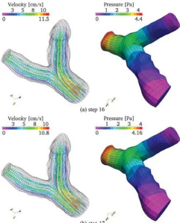 Fig. 10 – Equivalent (Plate top Von Misses) stress in the coronary artery wall: (a) step 16 and (b) step 17