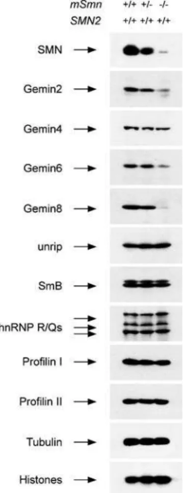 Figure 2. Analysis of SMN levels in different tissues of severe SMA mice. (A) Western blot analysis of total proteins from spinal cord, brain or kidney of normal (SMN2 +/+ ;mSmn +/+ ), carrier (SMN2 +/+ ;mSmn +/2 ) and severe SMA (SMN2 +/+ ;mSmn 2/2 ) mice