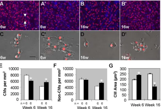 Figure 3. Myocyte hypertrophy contributes to early stages of cardiac remodeling in tr265/tr265 