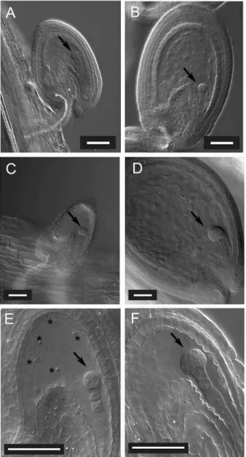 Figure 3. Fertilization with fbl17 mutant pollen leads to embryo developmental arrest and seed abortion