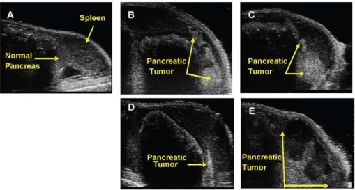 Figure 1 shows the real-time ultrasound acquired images of the USGI of 1 6 10 6 HCT116/dOR+ cells in a 20 m L bolus into the mouse pancreas