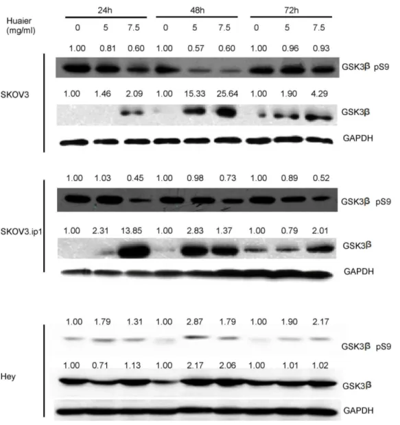 Figure 8. Huaier treatment enhances total GSK3b expression and inhibits phosphorylation of GSK3b at Ser 9 in SKOV3, SKOV3.ip1 and Hey cells