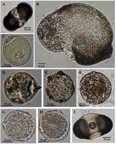 Fig. 5. Examples of photos of plant pollen grains from the high mountain snow from the Alps sampling sites: (A) – Pinus, (B) – Abies, (C) and (D) – Betula, (E) – Almus viridis, (F) – Dicranoweisia grimmiacea and triporate pollen grain – (G), (H); and from 