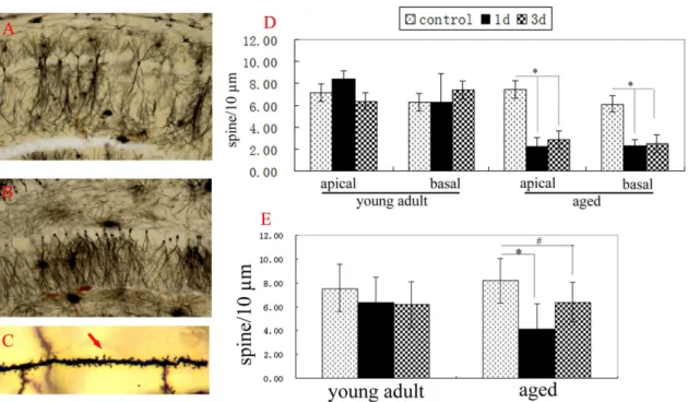 Figure 2. Hepatectomy differentially induced loss of dendritic spines of hippocampal neurons at adult and aged rats