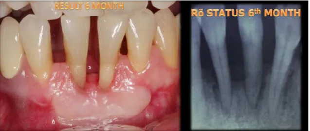 Fig. 5. Result on the sixth month.
