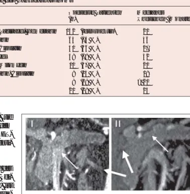 Abbildung 3: Lokal fortgeschrittenes Adenokarzinom des Pankreas. (I) zum Diagnosezeitpunkt mit Infiltration im Bereich des Convluens V