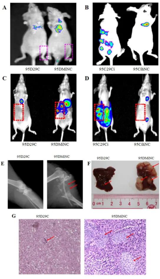 Figure 6. MiR-29c inhibits tumor metastasis in vivo . (A) miR-29c mimics suppress 95D cells metastasis to bone in vivo as shown by bioluminescence imaging after injection of 95D cells transfected with MiNC for 3–4 weeks, (%bone metastasis sites)