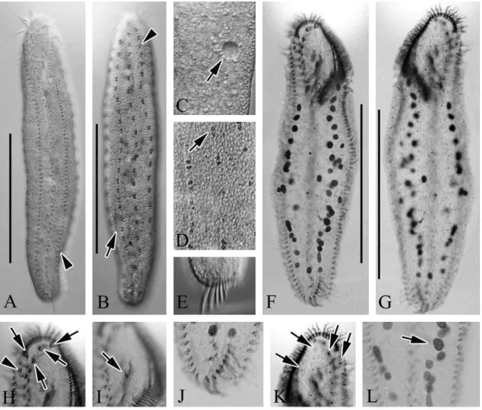 Fig. 2. Micrographs of Anteholosticha pulchra from live (A-E) and protargol impregnated (F-L) specimens