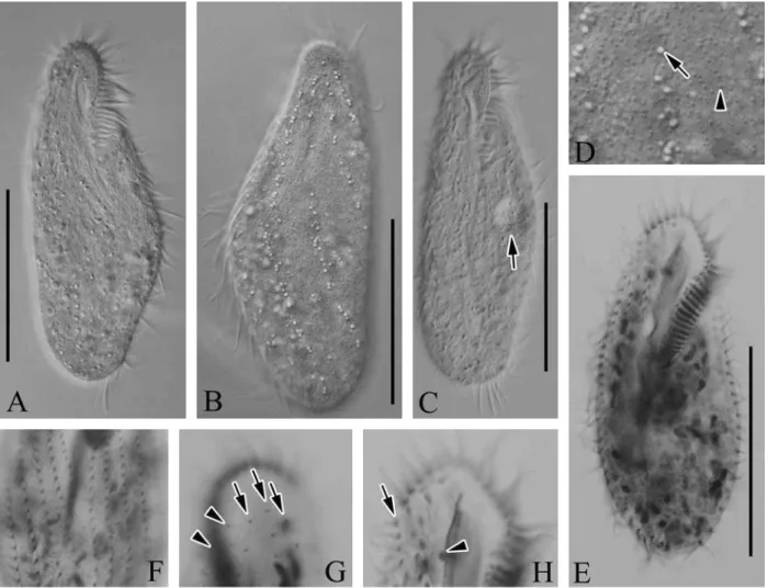 Fig. 3. Micrographs of Metaurostylopsis struederkypkeae from live (A-D) and protargol impregnated (E-H) specimen