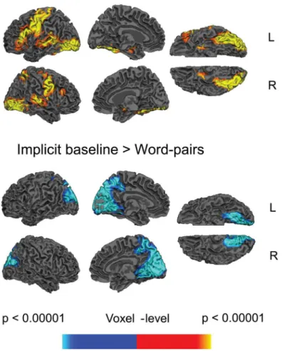 Fig 1. Statistical maps showing effects of word pairs versus implicit baseline. Yellow—red: more activity to word pairs than implicit baseline