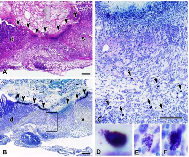 Figure 3. Mast cells in various stages of degranulation are present at the site of peptic ulceration