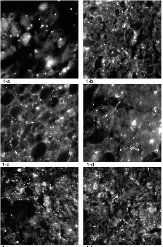 Fig. 1. he density of monoamine containing sympathetic nerve proiles representing as the luorescent spots in IBAT of SHR, visualised  by sucrose–phosphate–glyoxylic acid (SPG) histoluorescence method (De la Torre, 1980) 