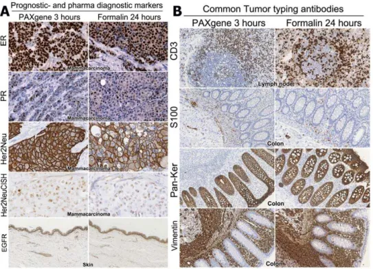 Figure 6. Histochemical stains show some qualitative differ- differ-ences between PAXgene and formalin fixation