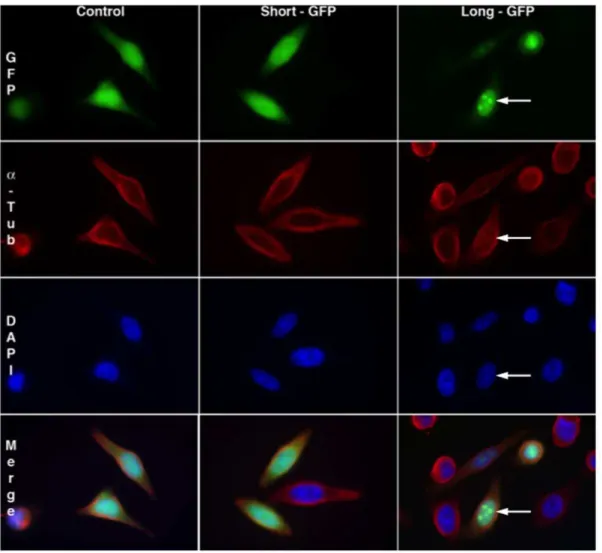 Figure 1. Subcellular localization of GFP fused with the short or long N-terminal sequence of Ilf3/NF90