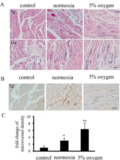 Fig 5. Hypoxia pretreatment of BM-MSCs promoted angiogenesis in DLLI muscle, as assessed by immunohistochemical staining