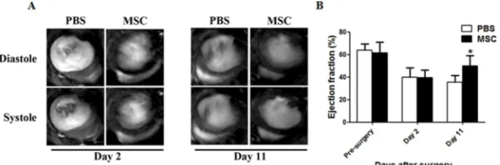 Fig 1. Cardiac functional analysis of infarcted hearts with MSCs transplantation. (A) Representative MRI images of hearts at day 2 and 11 in PBS-injected or MSC-transplanted mice