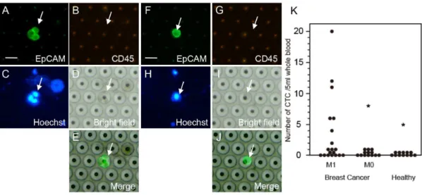 Figure 6. Detection and enumeration of CTC from patients with breast cancers. A–E. Representative CTC cluster showing EpCAM+/